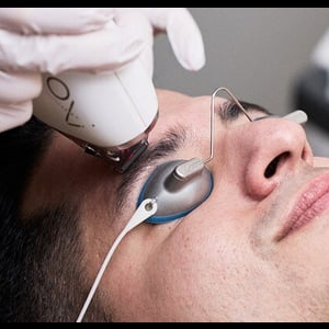 Resurfacing Laser (Moxi)
