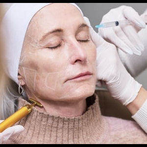 Biostimulatory Filler (Sculptra)