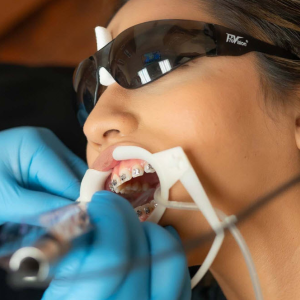 Preventive Dentistry
