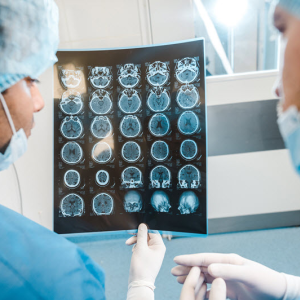 Neurological Conditions Physical Therapy