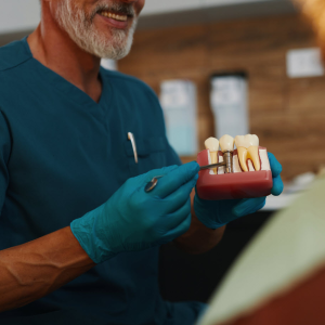 Dental Implants