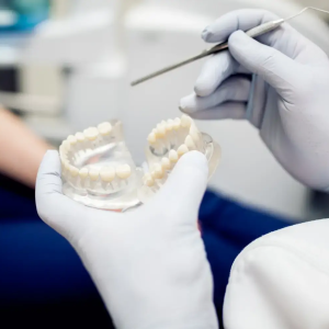 Dental Bridge