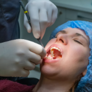 Wisdom Tooth Removal