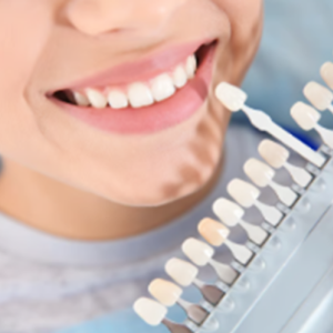 Teeth Whitening