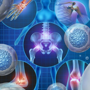 STEM CELL THERAPY