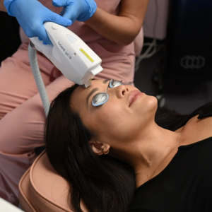 Hyperpigmentation