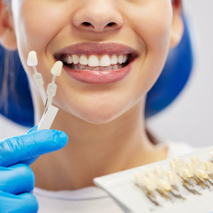 CEREC Same-Day Crowns