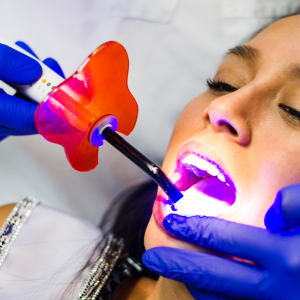 Cosmetic Bonding