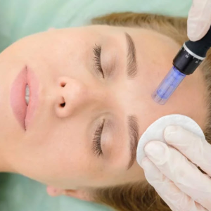 Microneedling