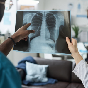 X-Ray