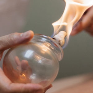 Cupping Therapy