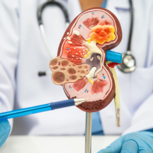 Nephrology Services