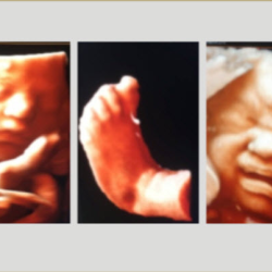 2D/3D/4D Ultrasound Scan