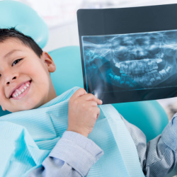 Radiographs (X-Rays) 