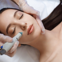 Microneedling