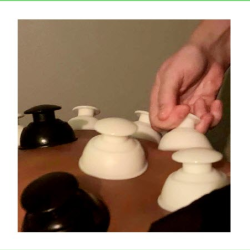 Cupping & Hot Stone Massage