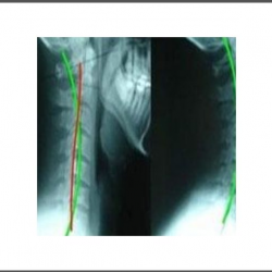 Chiropractic Postural Specific X-rays