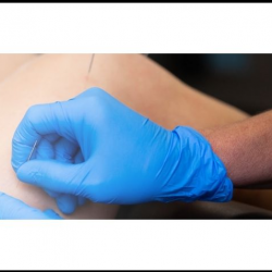 Dry Needling Services