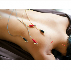 Electro-Acupuncture