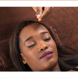 Acupuncture and Oriental Medicine