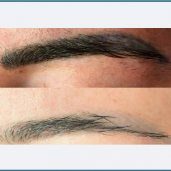 Microblading