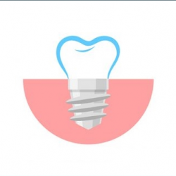 Implants (via specialist referral)