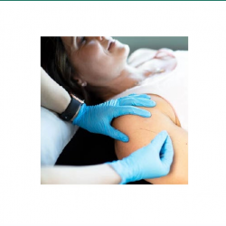 Trigger Point Dry Needling (TDN)