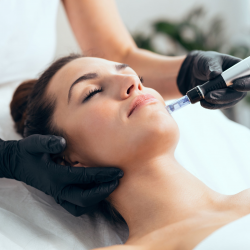 PRP Microneedling Facial