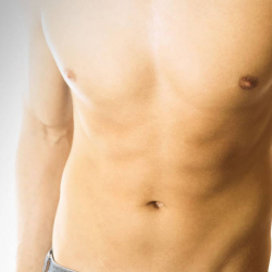 Gynecomastia Surgery