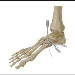 Trauma and Extremities