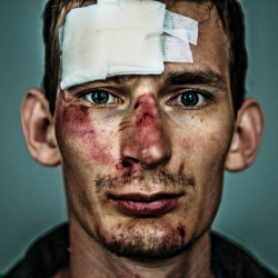 Concussion Management