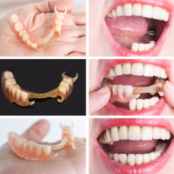 Partials and Dentures