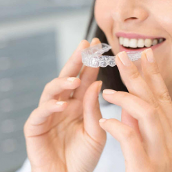SureSmile Aligners 