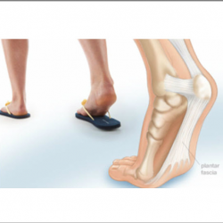 Heel Pain