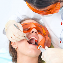 Dental Fillings