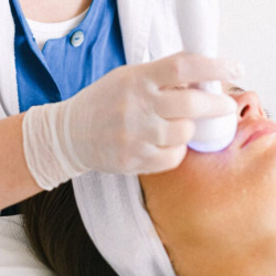  Radiofrequency Treatment