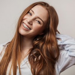 Traditional + Clear (Ceramic) Braces