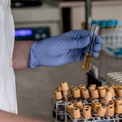 Laboratory Monitoring & Genetic Testing Services