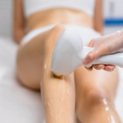 Laser Hair Removal