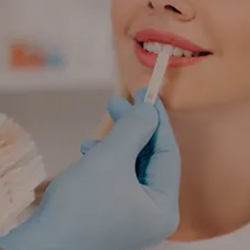 Teeth Whitening