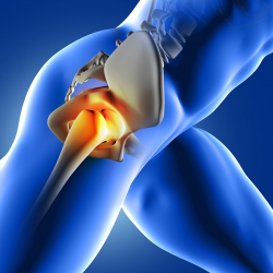 Orthopedic Hip Surgery