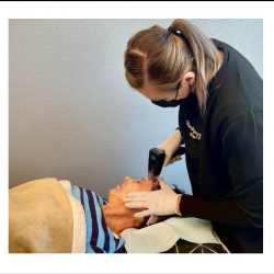 Morpheus 8 Treatment