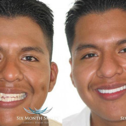  Orthodontics 