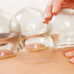 Cupping Therapy