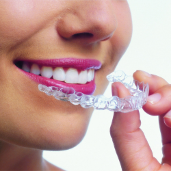 Invisalign