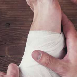 Bunions & Bunionettes