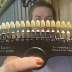 Teeth Whitening