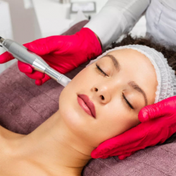 Microneedling Therapy