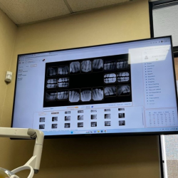 Oral Cancer Screenings