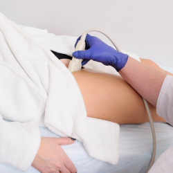 Lower Extremities Venous Ultrasound